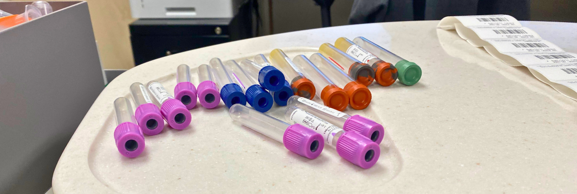 Tests Done for Menopause Symptoms and Relief